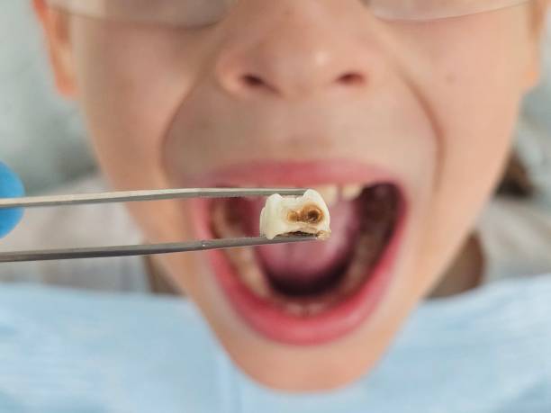 Best Pediatric Emergency Dentist in Waunakee, WI